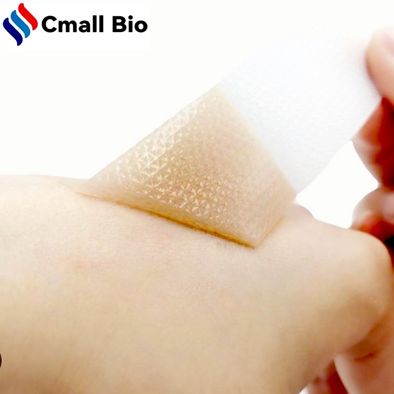 Zer egin Orbain gorri eta azkurarekin? CmallBio silikonazko gel orbain xaflak lagun dezake