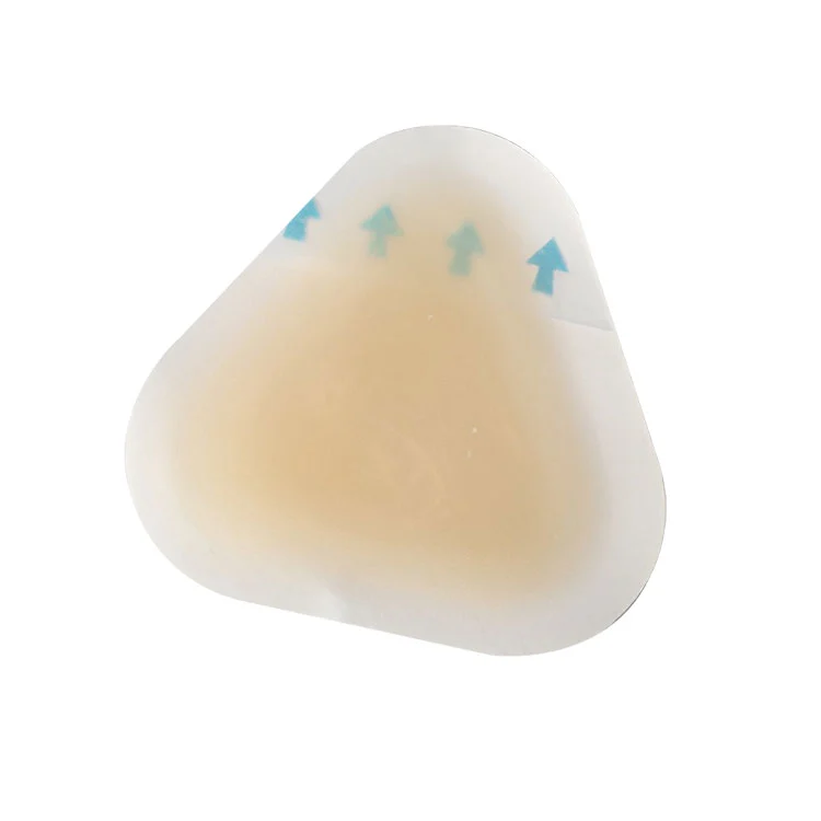 Anpuluen prebentzioa orpoetarako